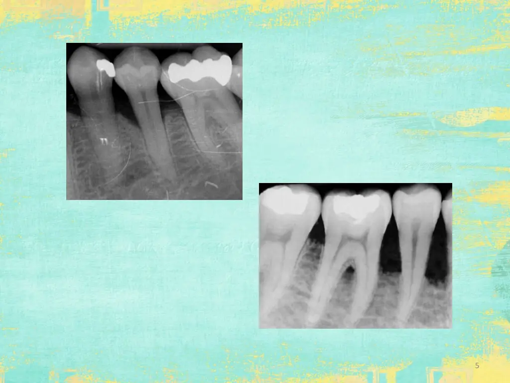 slide5