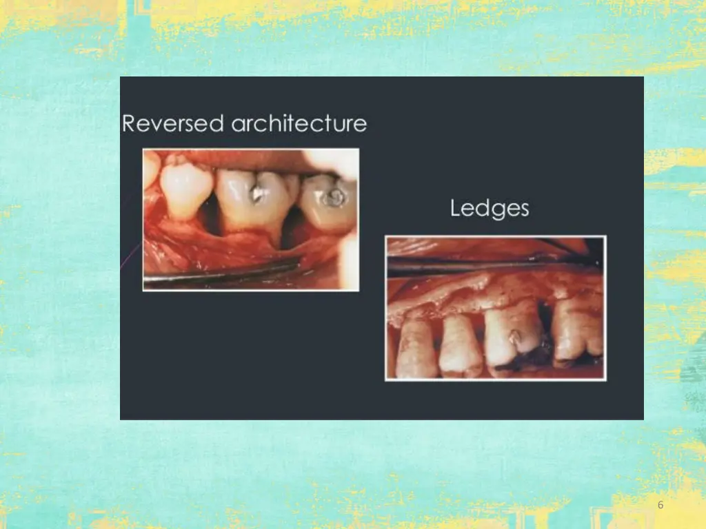 slide6