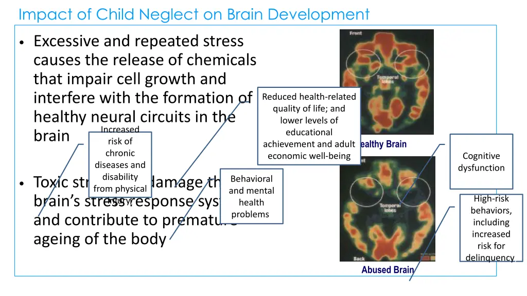 impact of child neglect on brain development