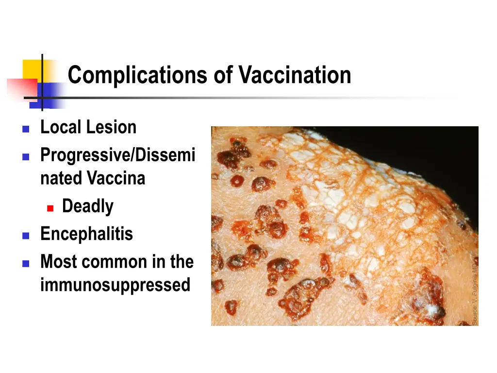 complications of vaccination