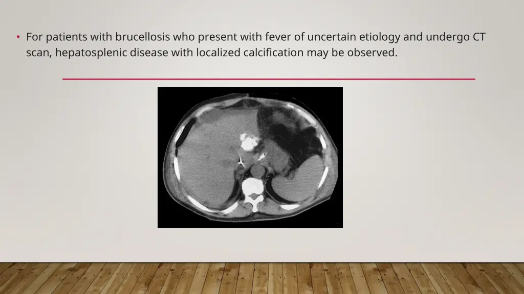 for patients with brucellosis who present with