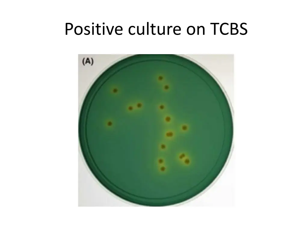 positive culture on tcbs