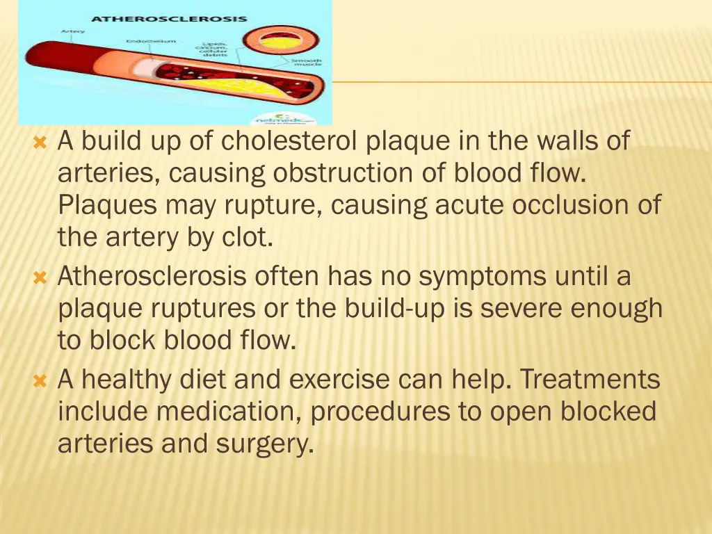 a build up of cholesterol plaque in the walls