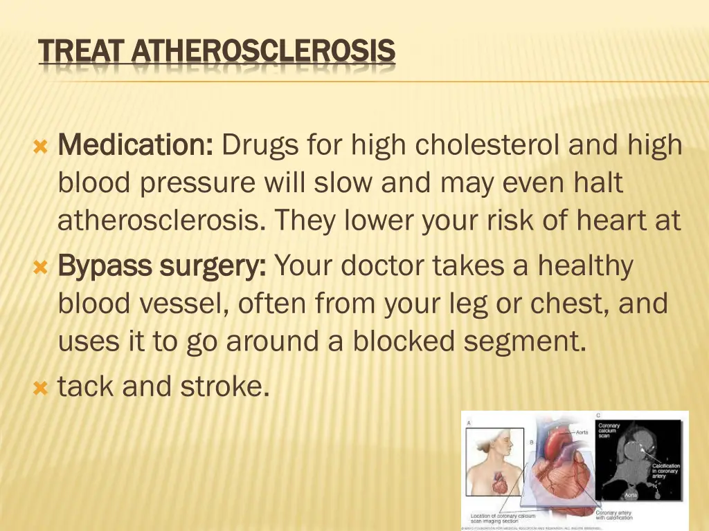 treat atherosclerosis treat atherosclerosis