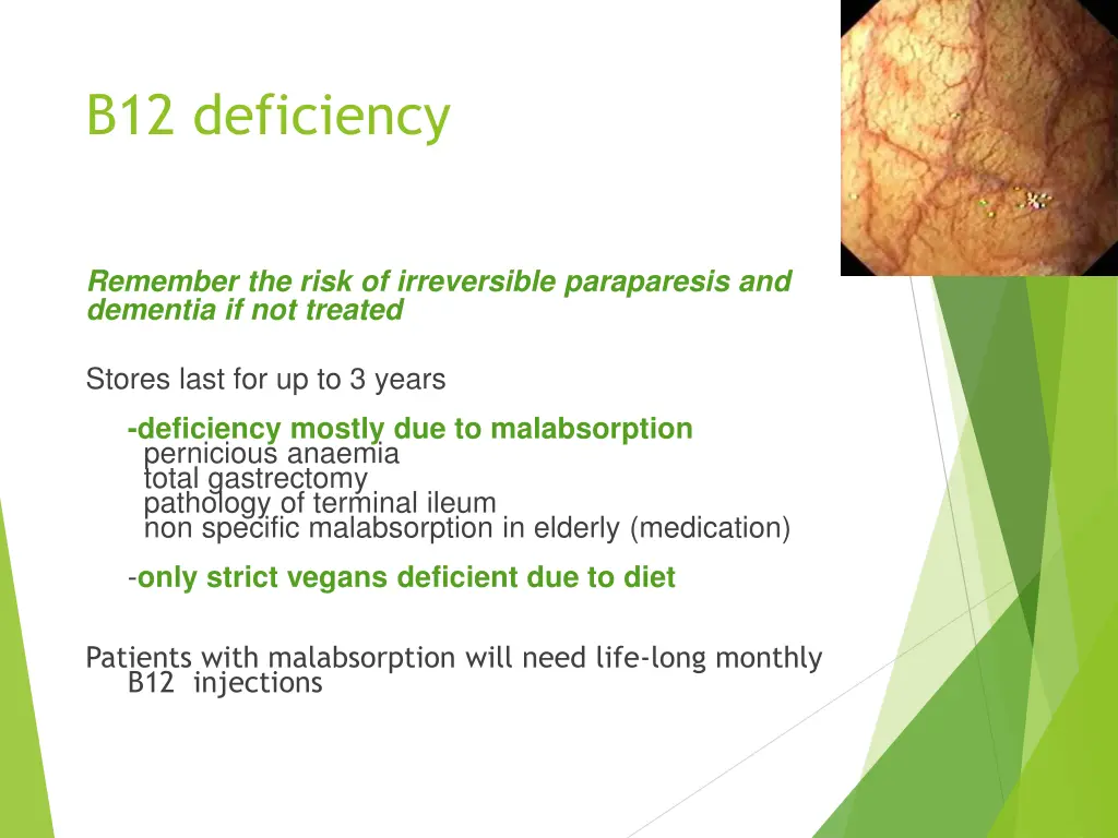 b12 deficiency