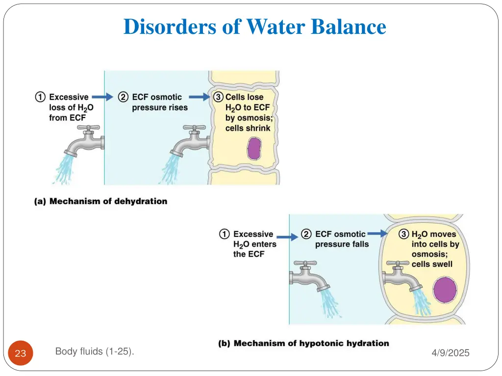 disorders of water balance