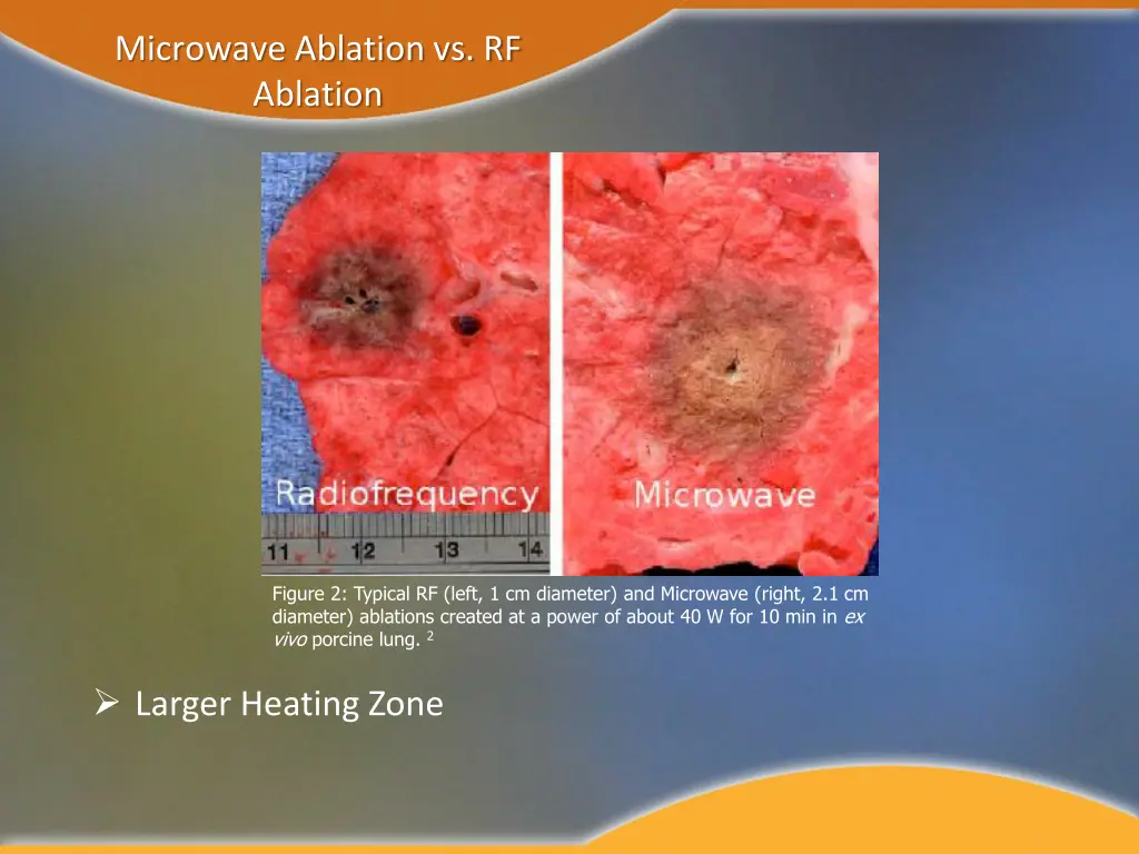 microwave ablation vs rf ablation 1