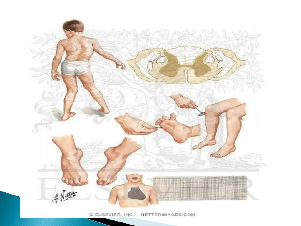 slide44