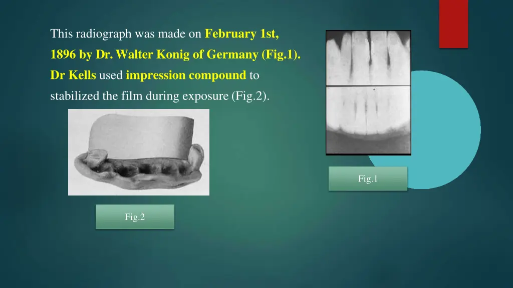 this radiograph was made on february 1st 1896