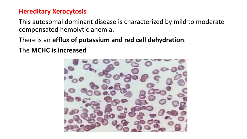 hereditary xerocytosis this autosomal dominant