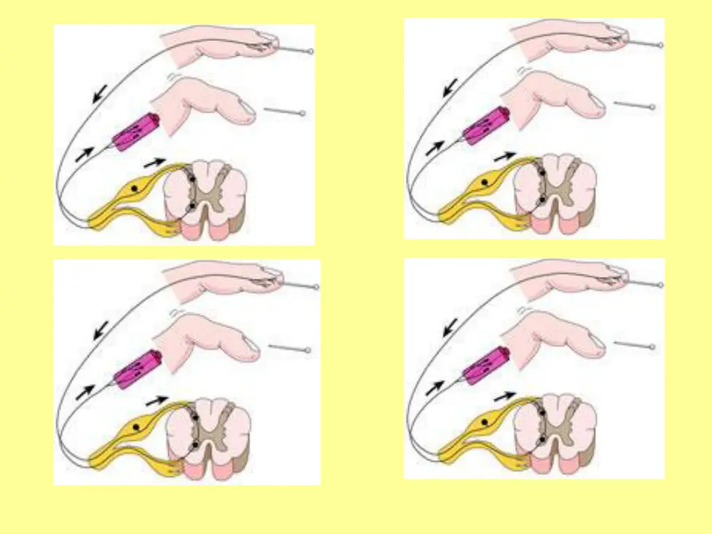 slide15