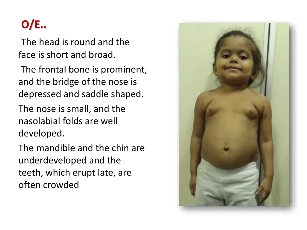 o e the head is round and the face is short