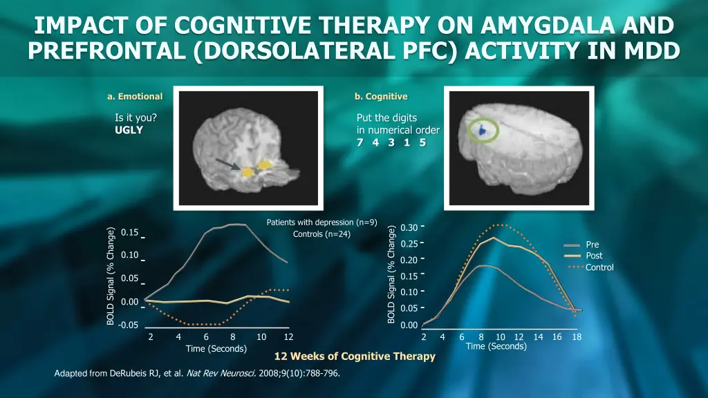 impact of cognitive therapy on amygdala