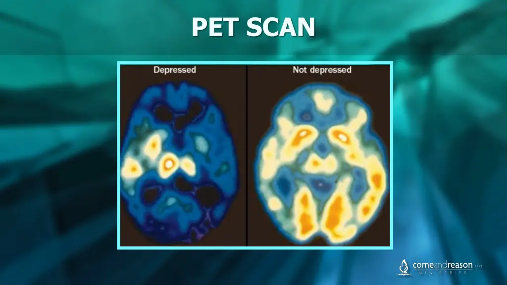 pet scan