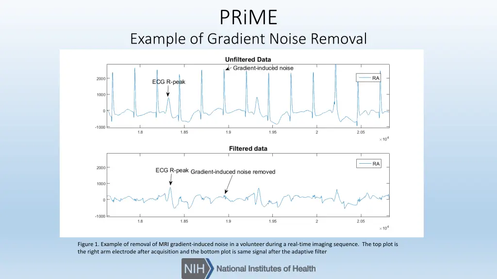 prime 2