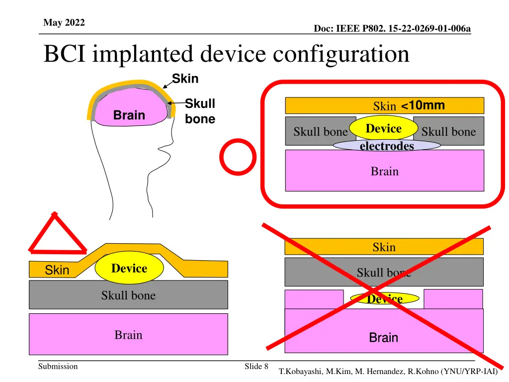 may 2022 bci implanted device configuration skin