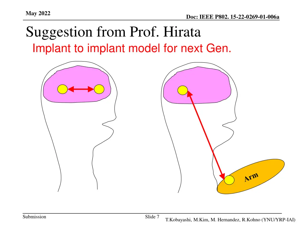 may 2022 suggestion from prof hirata implant