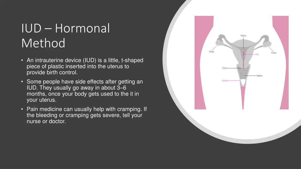 iud hormonal method