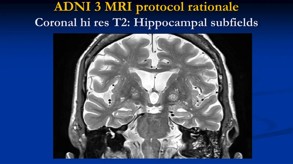 adni 3 mri protocol rationale coronal