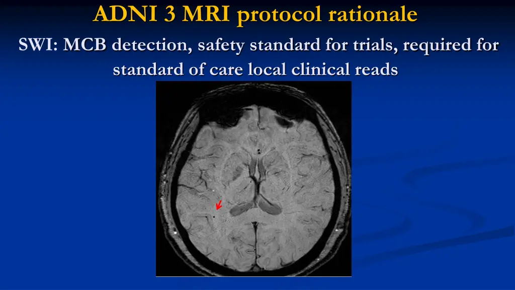 adni 3 mri protocol rationale swi mcb detection