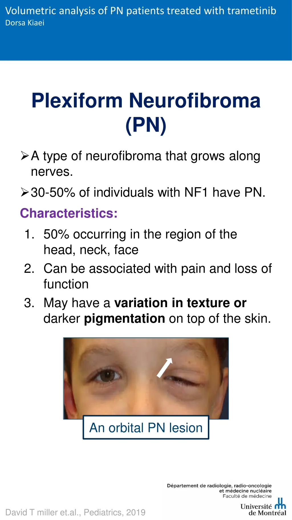 volumetric analysis of pn patients treated with 1