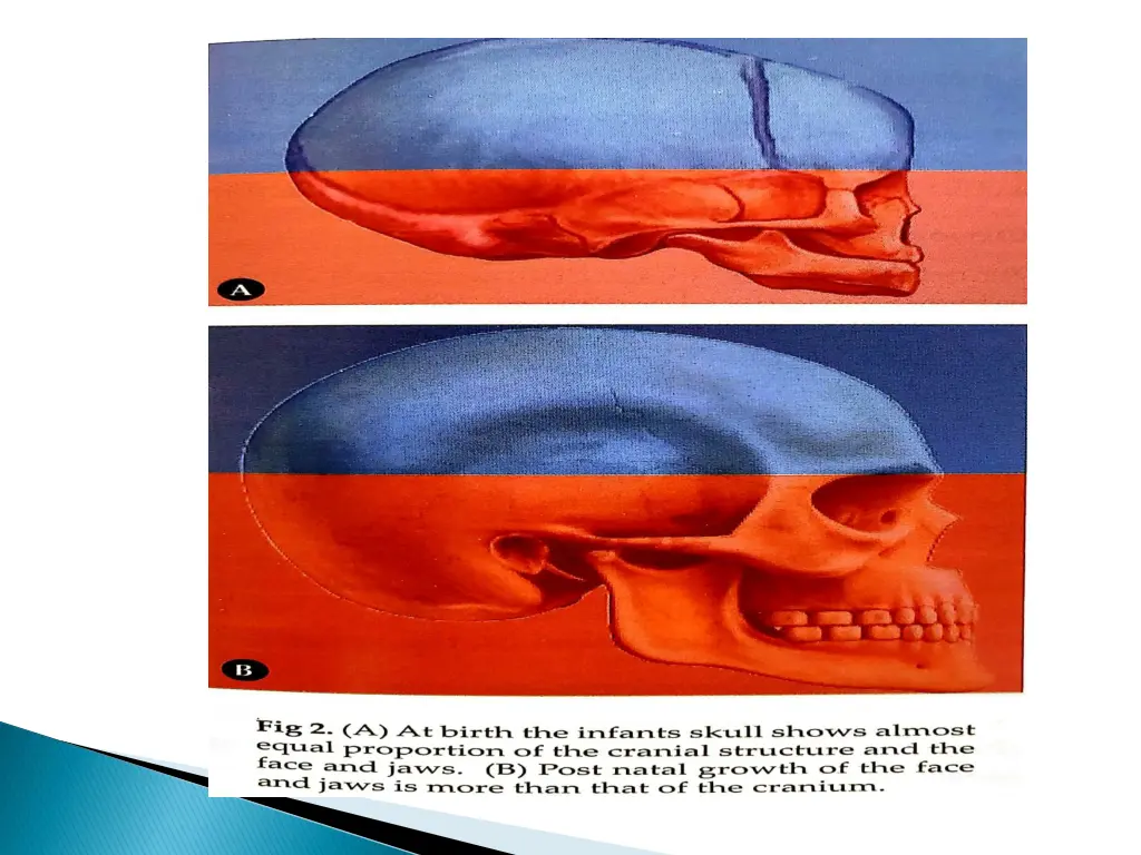 slide16