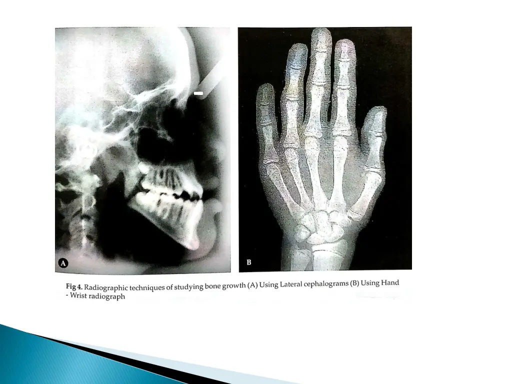 slide19