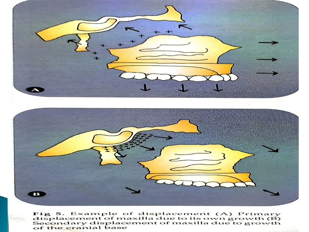 slide22