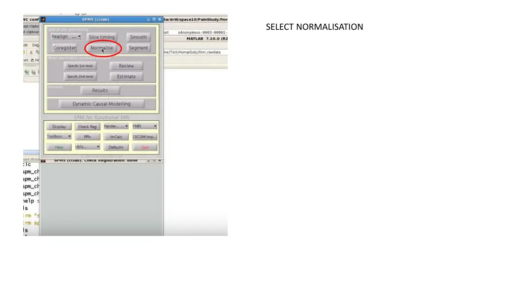 select normalisation