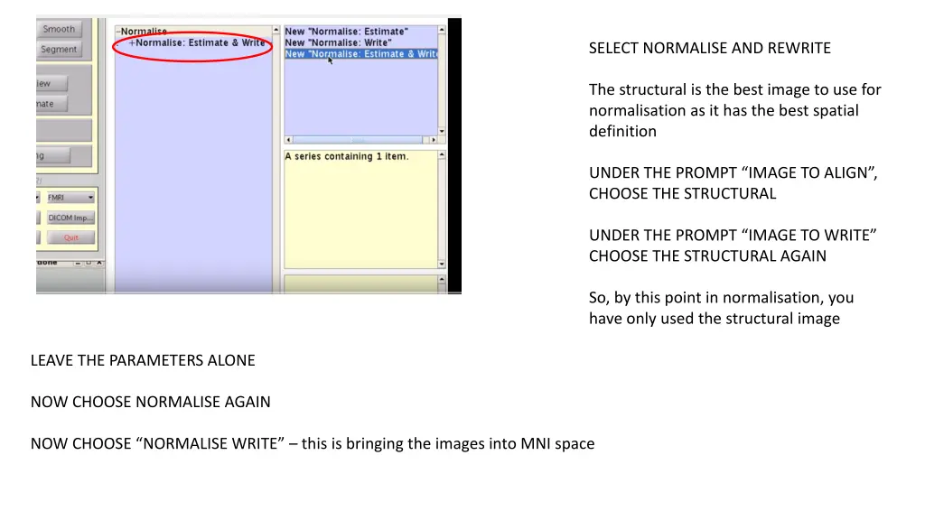 select normalise and rewrite