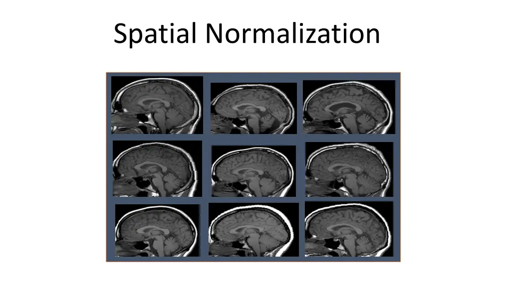 spatial normalization