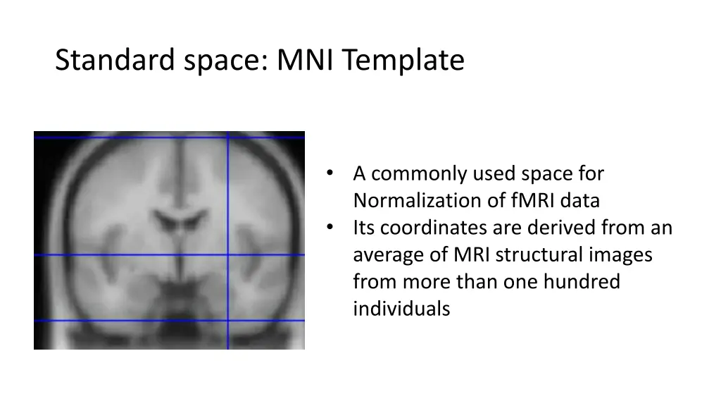 standard space mni template