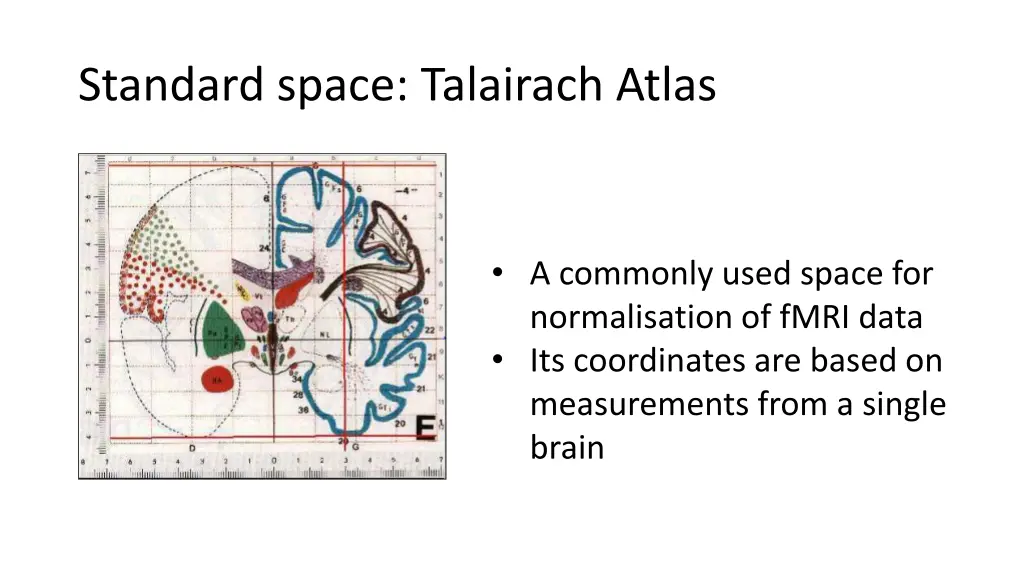 standard space talairach atlas