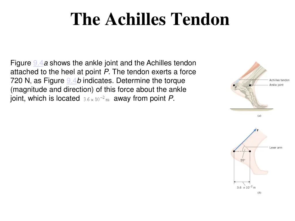 the achilles tendon