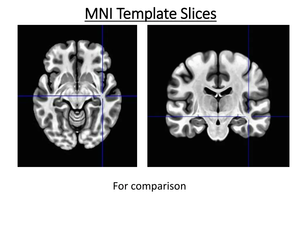 mni template slices mni template slices