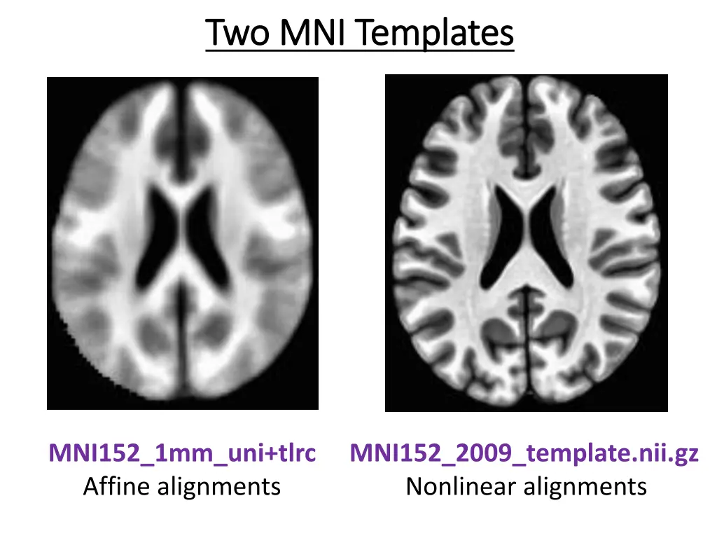 two mni templates two mni templates