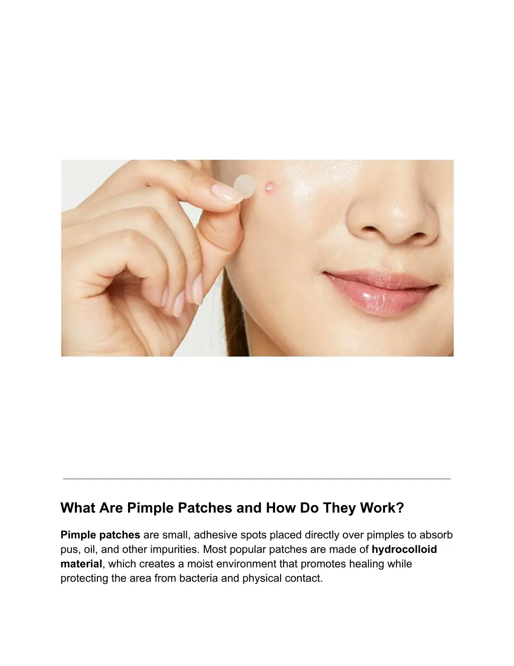 what are pimple patches and how do they work