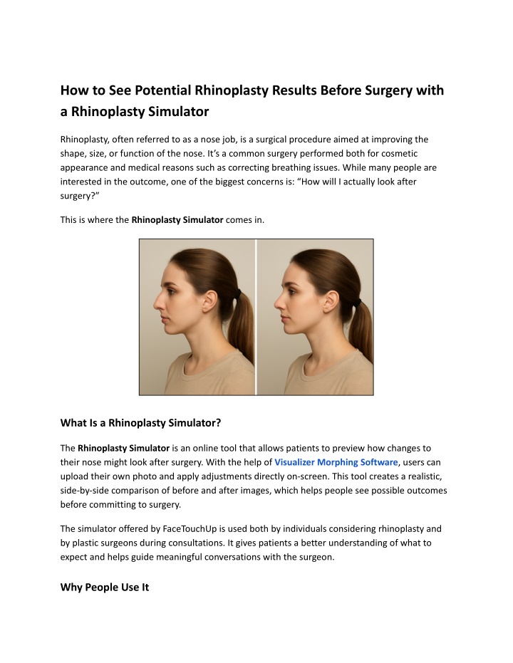 how to see potential rhinoplasty results before