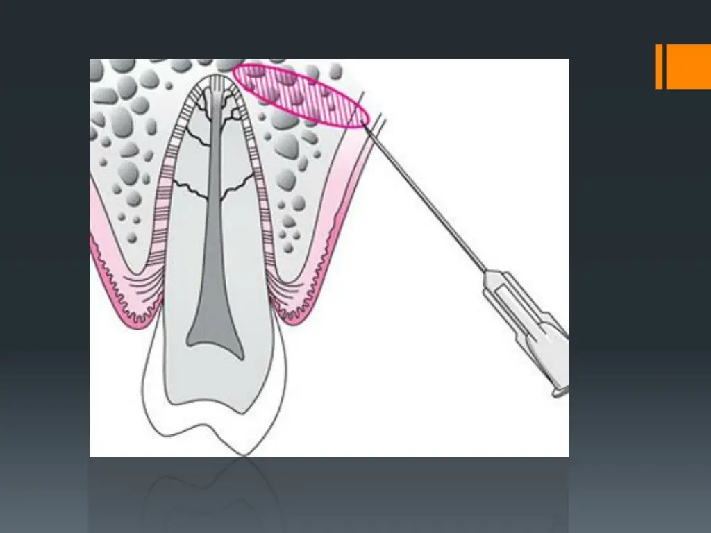slide10