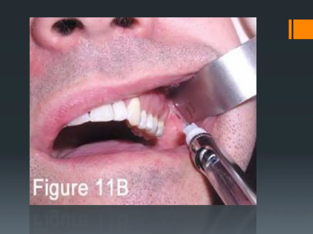 slide18