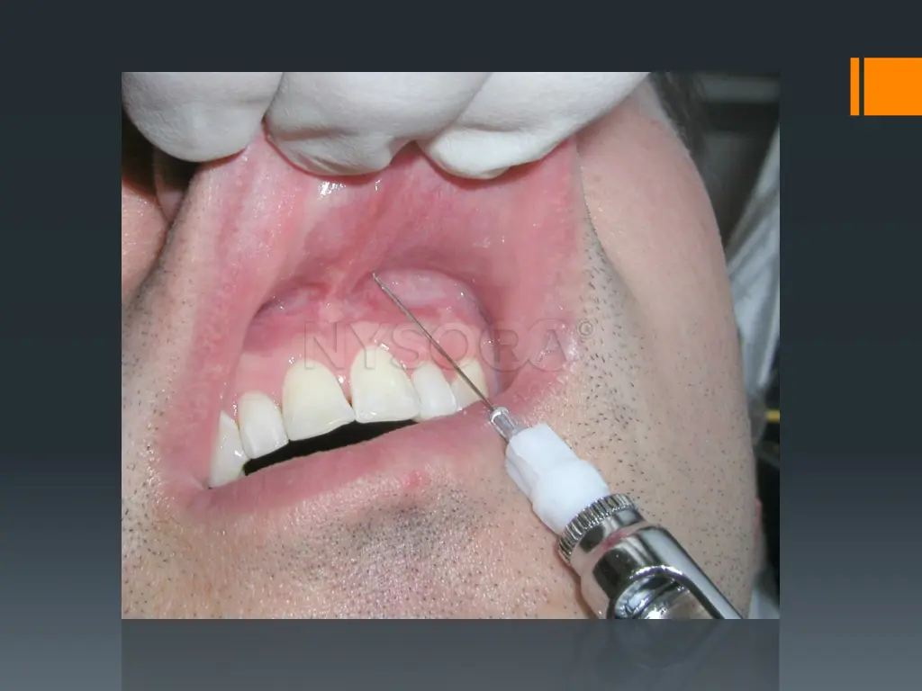 slide22