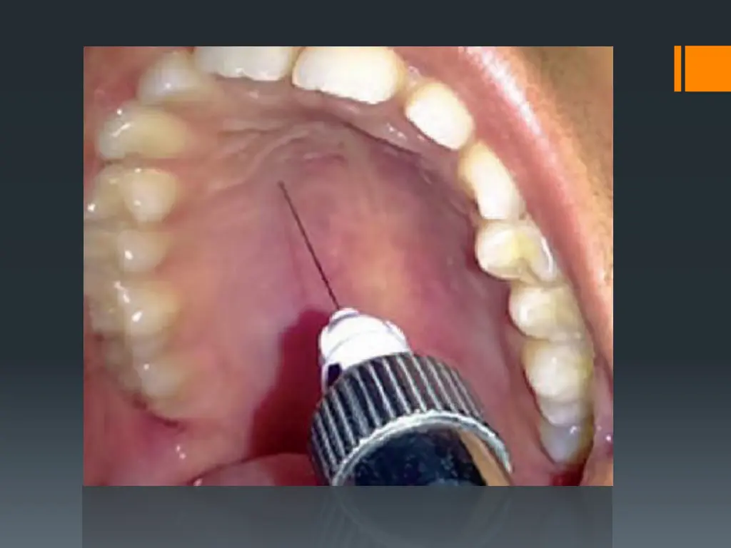 slide24