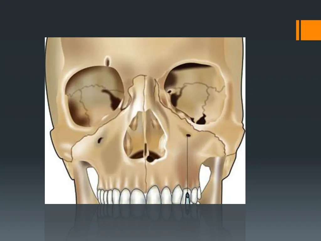 slide27