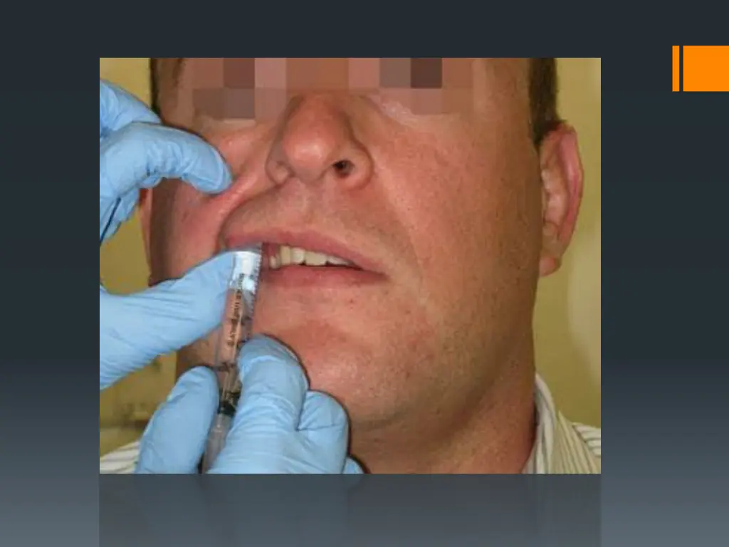 slide28