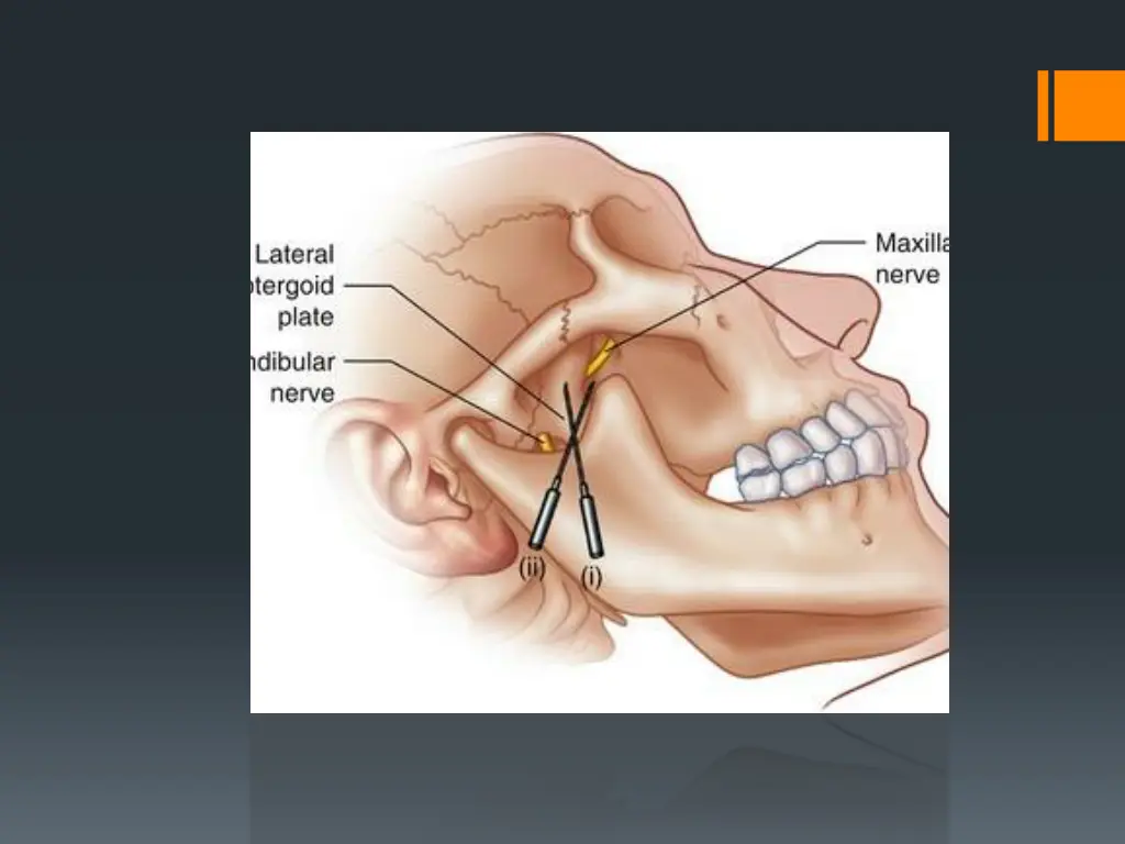 slide30