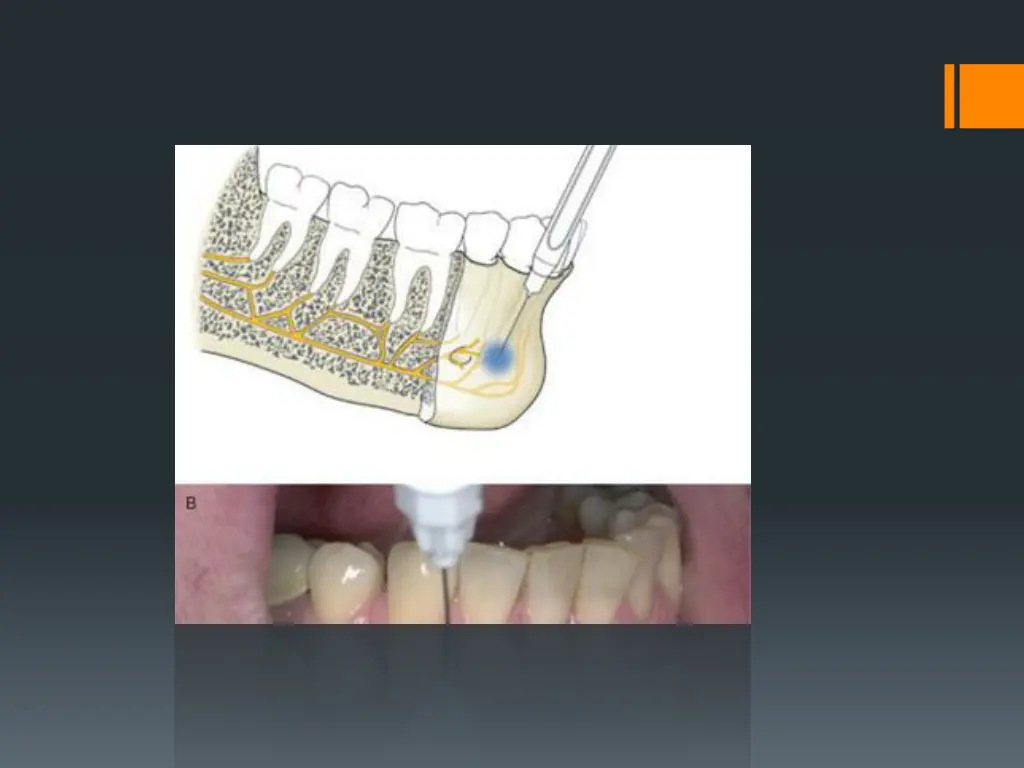 slide33