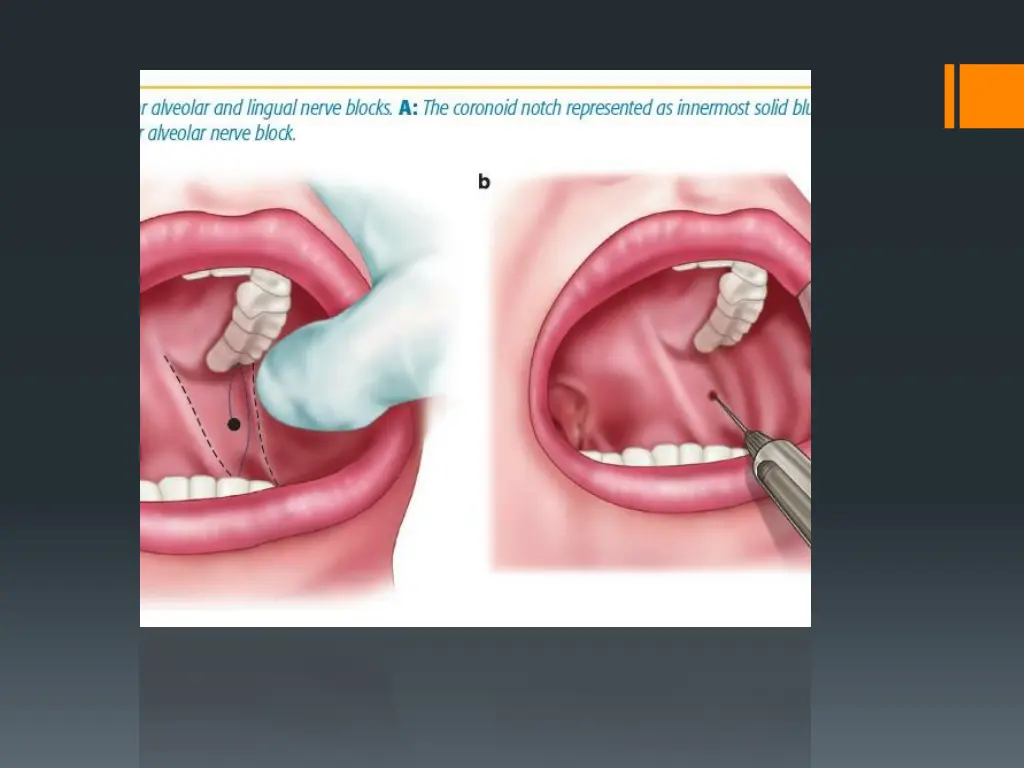 slide36