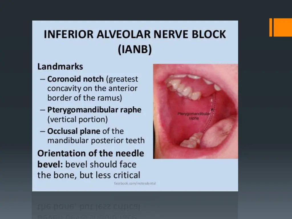 slide37