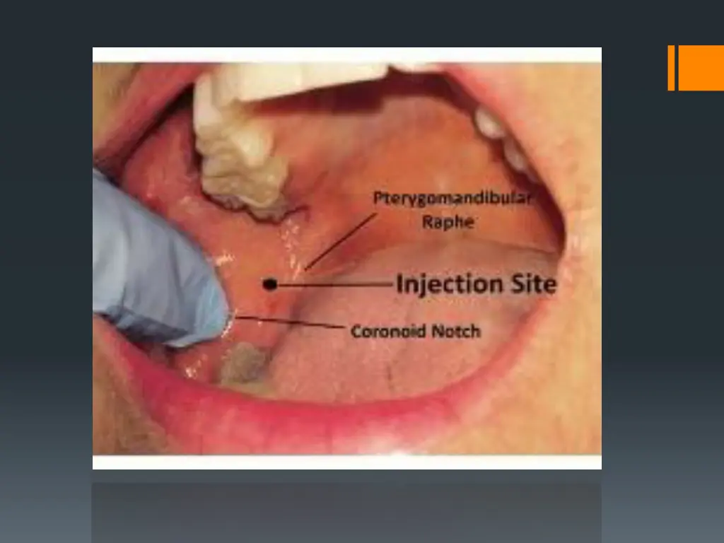 slide38
