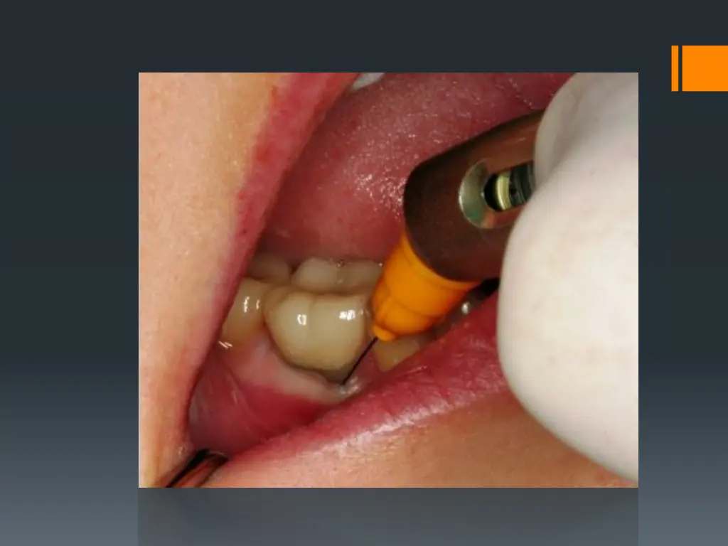 slide43
